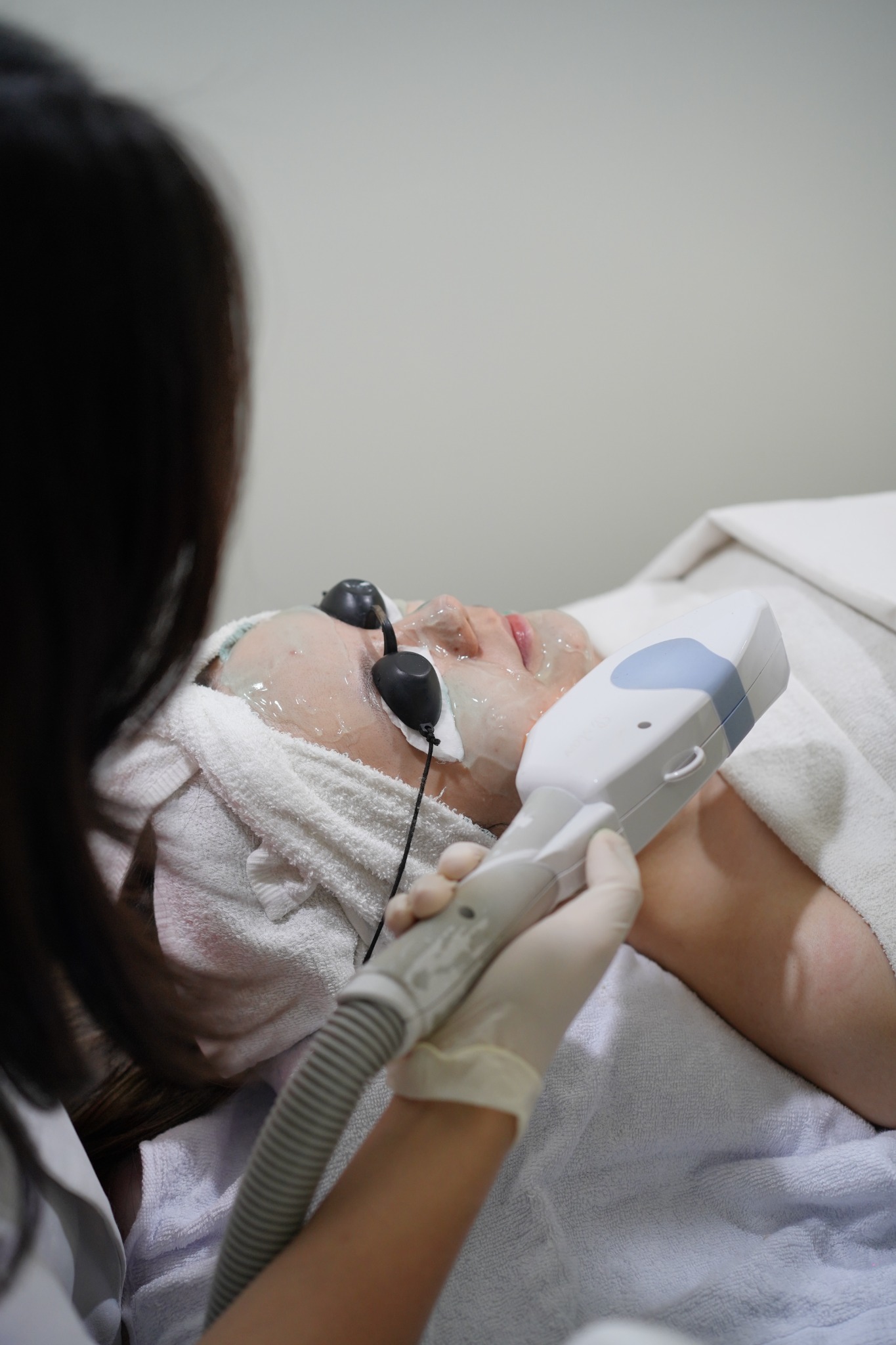 Dokumentasi treatment IPL CHARISMA