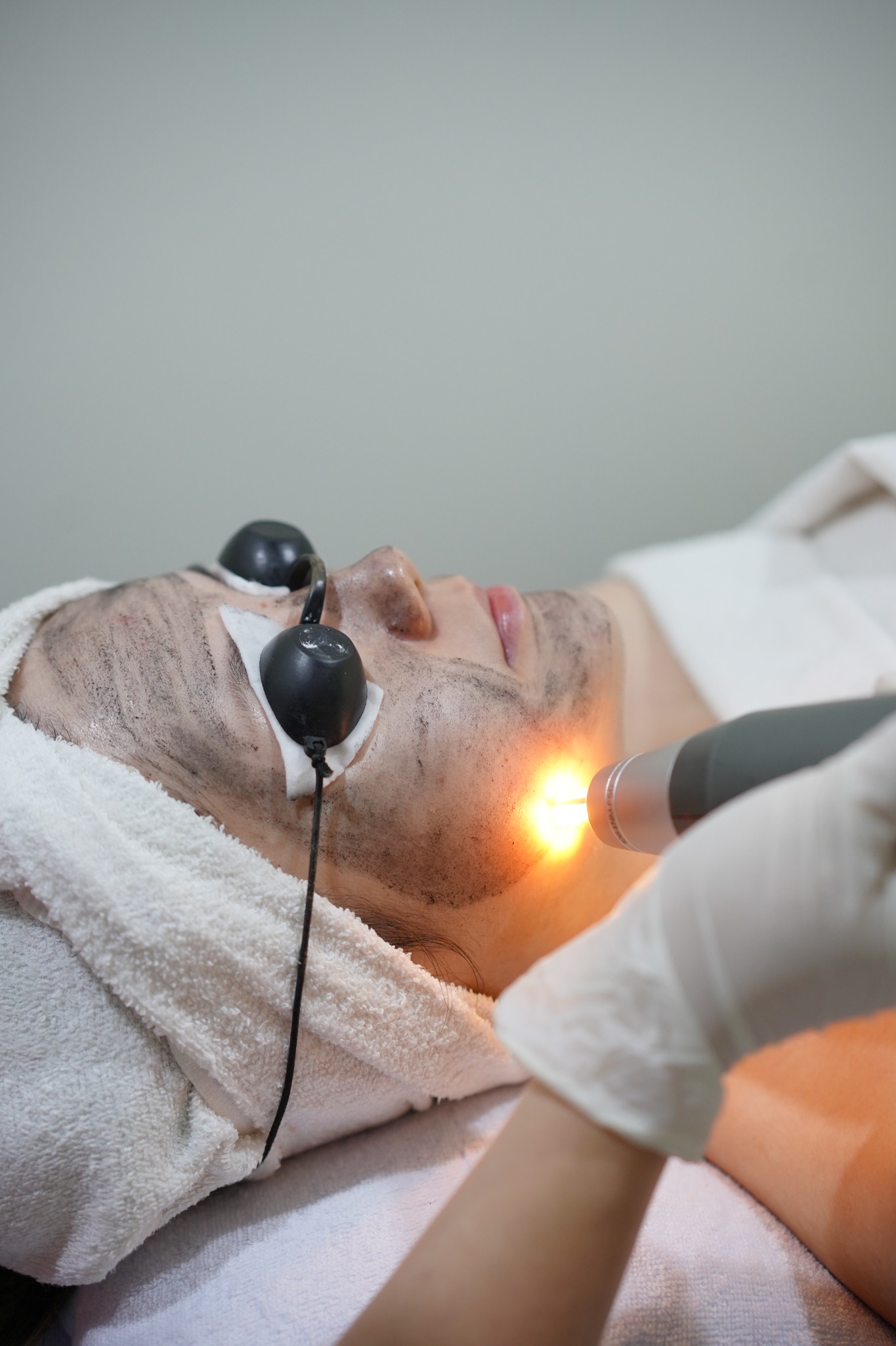 Dokumentasi treatment Laser Triple Action CHARISMA